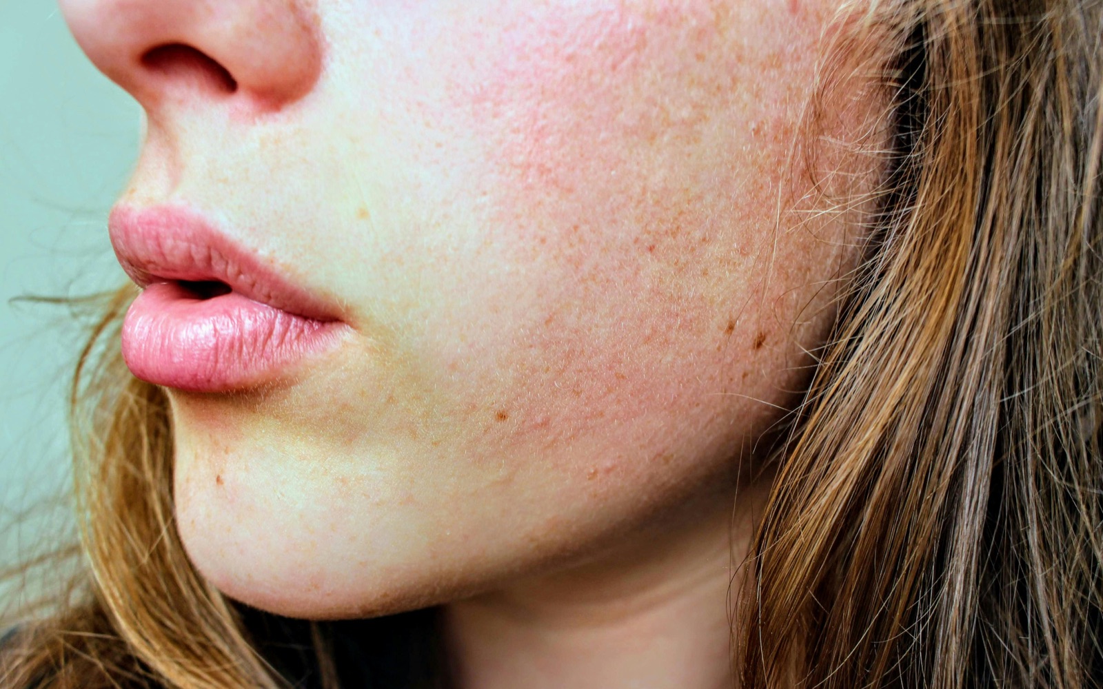 Close-up of facial skin texture and even tone representing the hyperpigmentation outcomes tranexamic acid targets